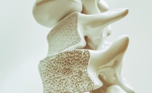 Nahaufnahme eines porösen Knochens