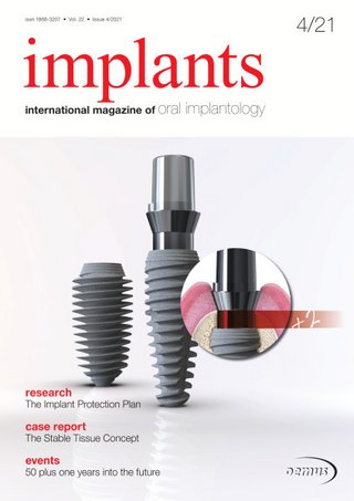 Implants 