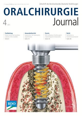 Oralchirurgie Journal