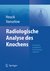 E-Book Radiologische Analyse des Knochens