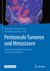 E-Book Peritoneale Tumoren und Metastasen