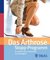E-Book Das Arthrose-Stopp-Programm