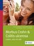 E-Book Morbus Crohn & Colitis ulcerosa