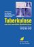 E-Book Tuberkulose und nicht tuberkulöse Mykobakteriosen heute