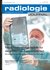 radiologie JOURNAL radiologie JOURNAL