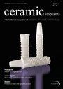 Ceramic Implants