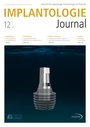 Implantologie Journal